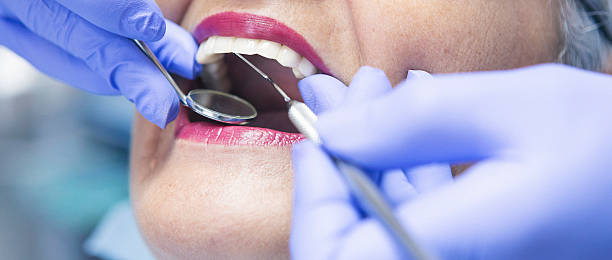 Best Emergency Broken Tooth Repair in Questa, NM